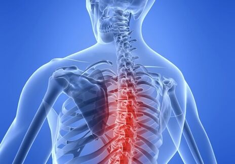 osteohondroza torakalne hrbtenice