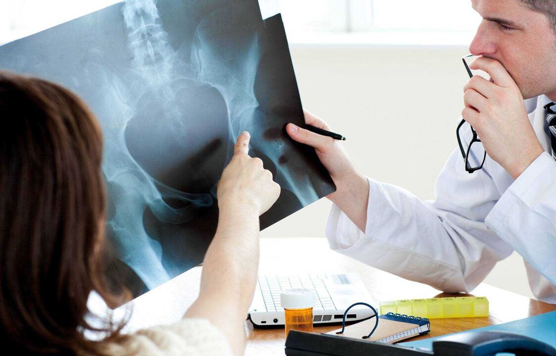 zdravniki, ki rentgensko pregledujejo artrozo kolka
